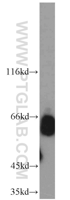 KEAP1 western blot WB 10503-2-AP KEAP1 Antibody INrf2; KIAA0132; KLHL19; MGC10630; MGC1114; MGC20887; MGC4407; MGC9454