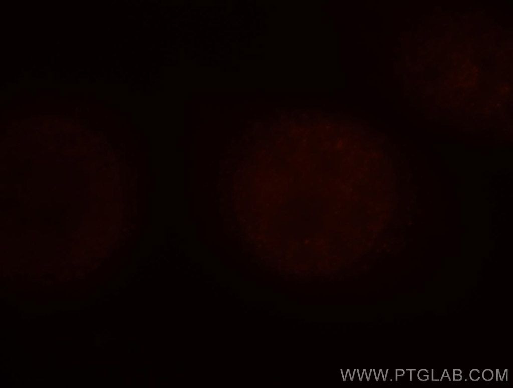 KHDRBS1 Immunofluorescence IF 10222-1-AP KHDRBS1 Antibody FLJ34027; Sam68; p62