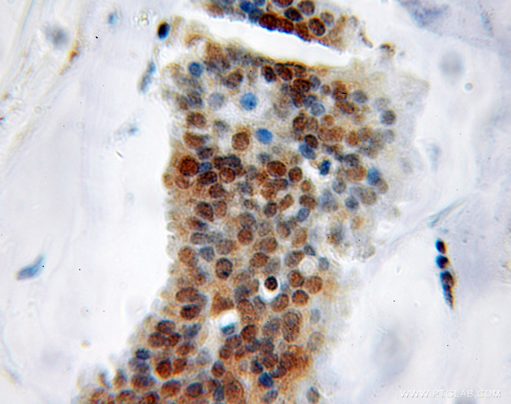 KHDRBS1 IHC Immunohistochemical 10222-1-AP KHDRBS1 Antibody FLJ34027; Sam68; p62