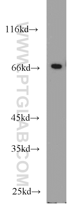 KHDRBS1 western blot WB 10222-1-AP KHDRBS1 Antibody FLJ34027; Sam68; p62