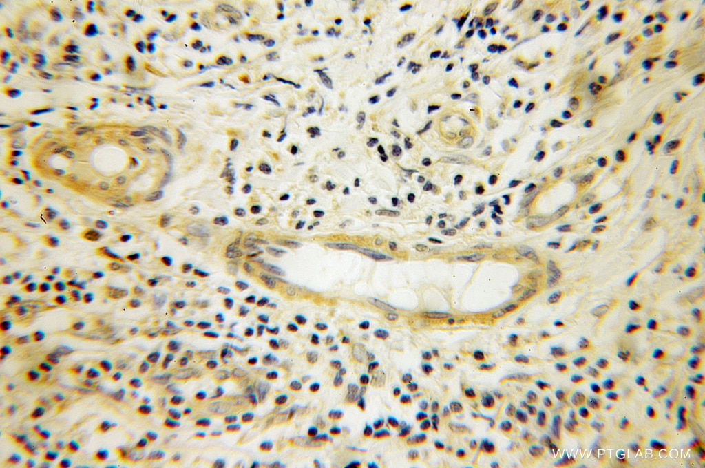 KIAA0325 IHC Immunohistochemical 12345-1-AP KIAA0325 Antibody DHC1; DHC1a; DKFZp686P2245; DNCH1; DNCL; DNECL; DYHC; Dnchc1; HL-3; KIAA0325; p22