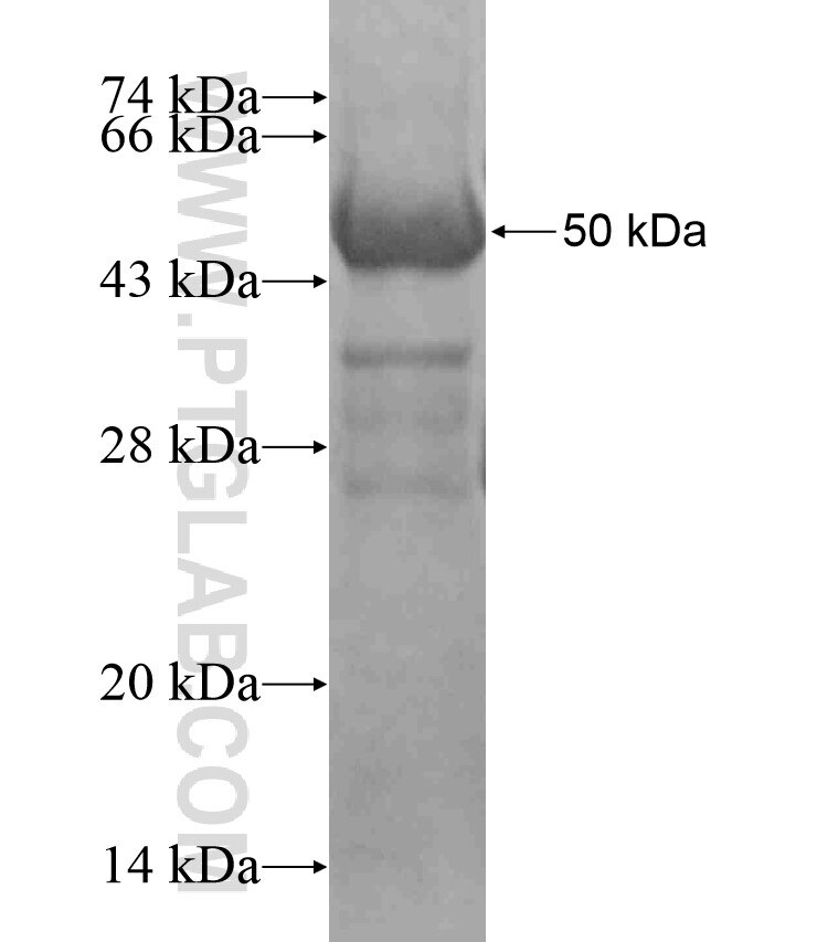 KIAA0406 fusion protein ag17697 SDS-PAGE