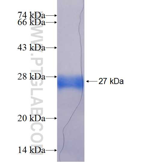 KIAA0892 fusion protein ag19943 SDS-PAGE