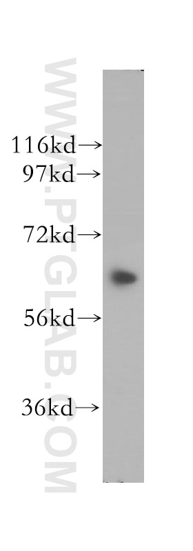 KIF12 western blot WB 12035-1-AP KIF12 Antibody RP11-56P10.3