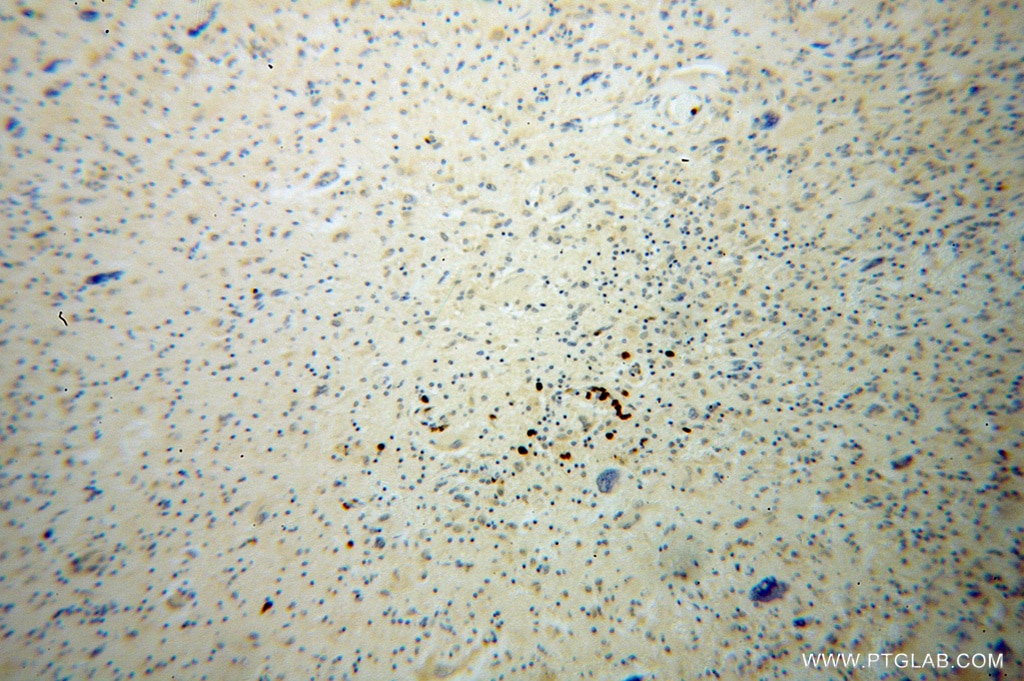 KIF3A IHC Immunohistochemical 13930-1-AP KIF3A Antibody 