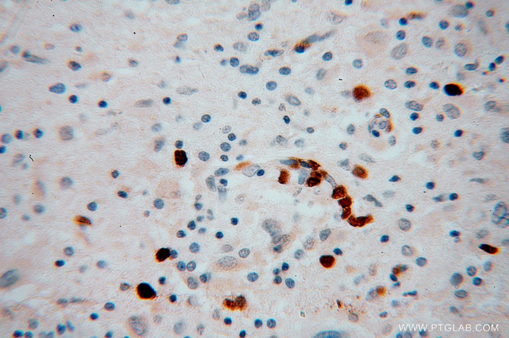 KIF3A IHC Immunohistochemical 13930-1-AP KIF3A Antibody 