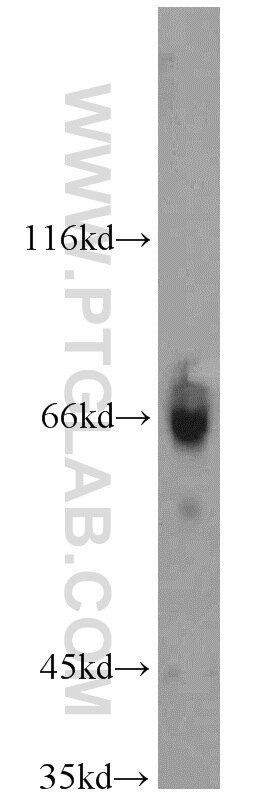 KIFC1 western blot WB 20790-1-AP KIFC1 Antibody HSET; KNSL2; MGC1202; MGC149736; MGC149737