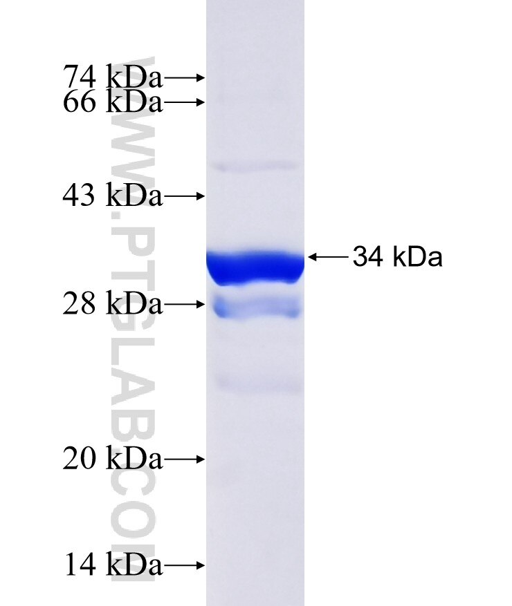 KNCN fusion protein ag16160 SDS-PAGE