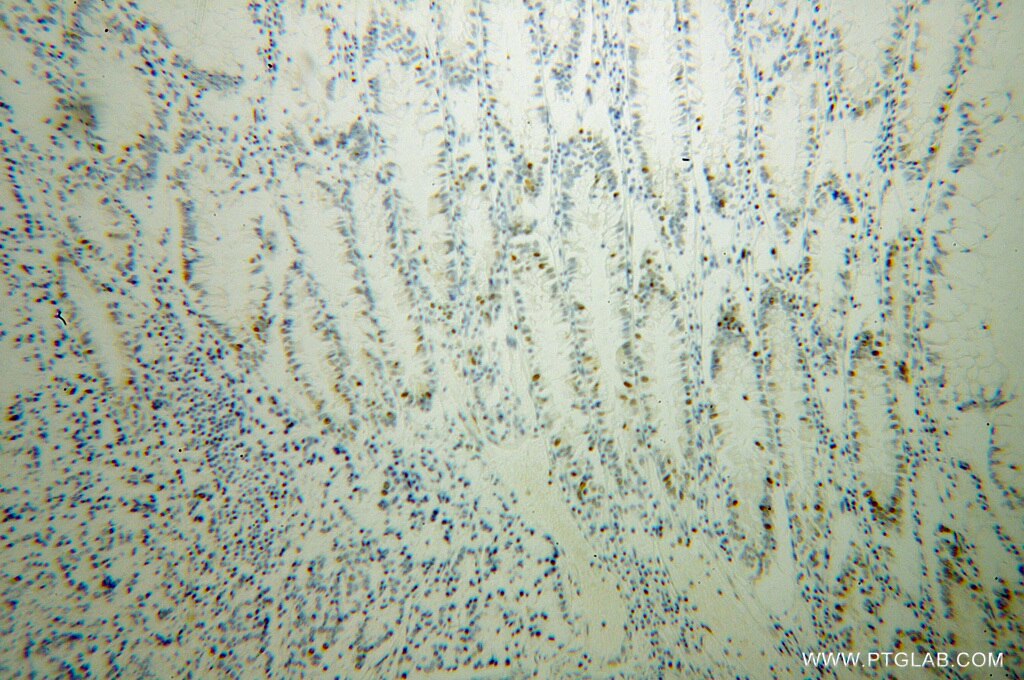 KPNA2 IHC Immunohistochemical 10819-1-AP KPNA2 Antibody IPOA1; QIP2; RCH1; SRP1alpha