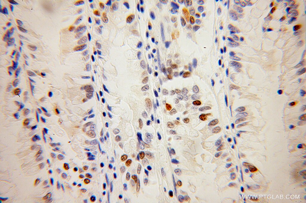 KPNA2 IHC Immunohistochemical 10819-1-AP KPNA2 Antibody IPOA1; QIP2; RCH1; SRP1alpha