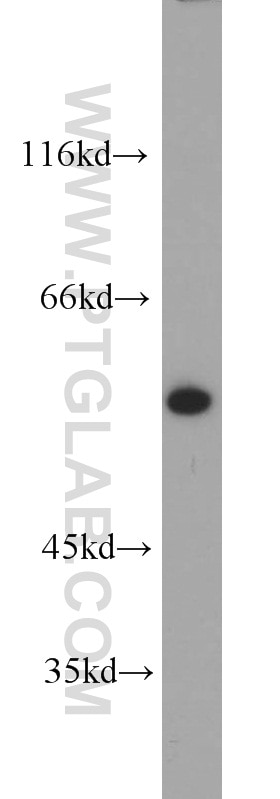 KPNA2 western blot WB 10819-1-AP KPNA2 Antibody IPOA1; QIP2; RCH1; SRP1alpha