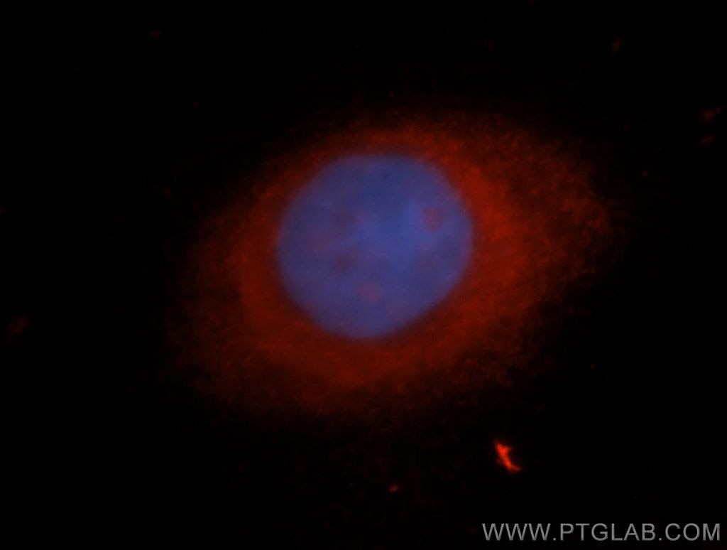 KRT14 Immunofluorescence IF 10143-1-AP KRT14 Antibody CK14; EBS3; EBS4; K14; NFJ