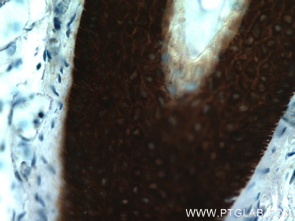 Immunohistochemistry of paraffin-embedded human skin using KRT14 Antibody 10143-1-AP (under 40x lens) KRT14 IHC Immunohistochemistry 10143-1-AP KRT14 Antibody CK14; EBS3; EBS4; K14; NFJ
