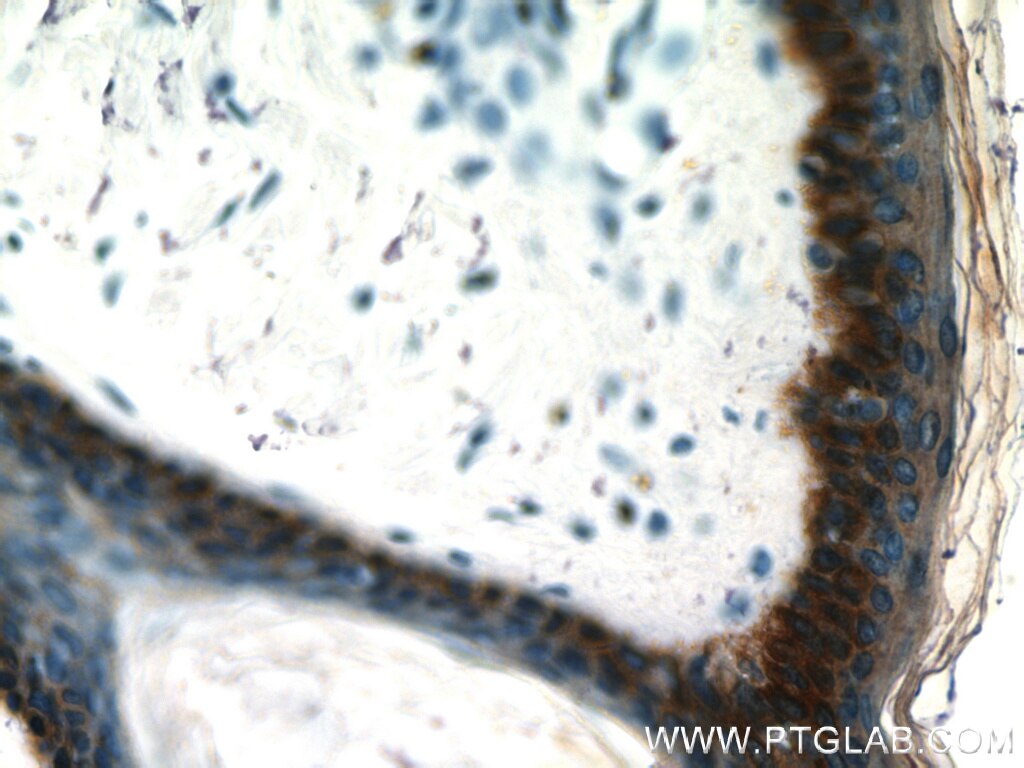 Immunohistochemistry of paraffin-embedded human skin using KRT14 Antibody 10143-1-AP (under 40x lens) KRT14 IHC Immunohistochemistry 10143-1-AP KRT14 Antibody CK14; EBS3; EBS4; K14; NFJ