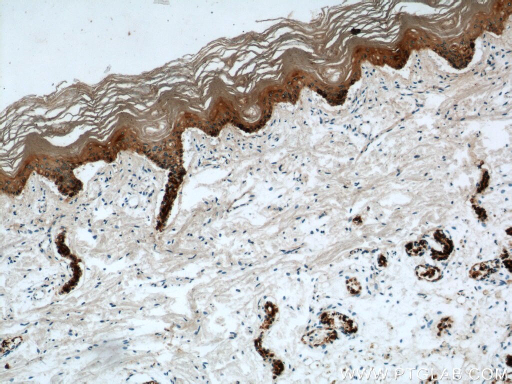 Immunohistochemistry of paraffin-embedded human skin using KRT14 Antibody 10143-1-AP (under 10x lens) KRT14 IHC Immunohistochemistry 10143-1-AP KRT14 Antibody CK14; EBS3; EBS4; K14; NFJ