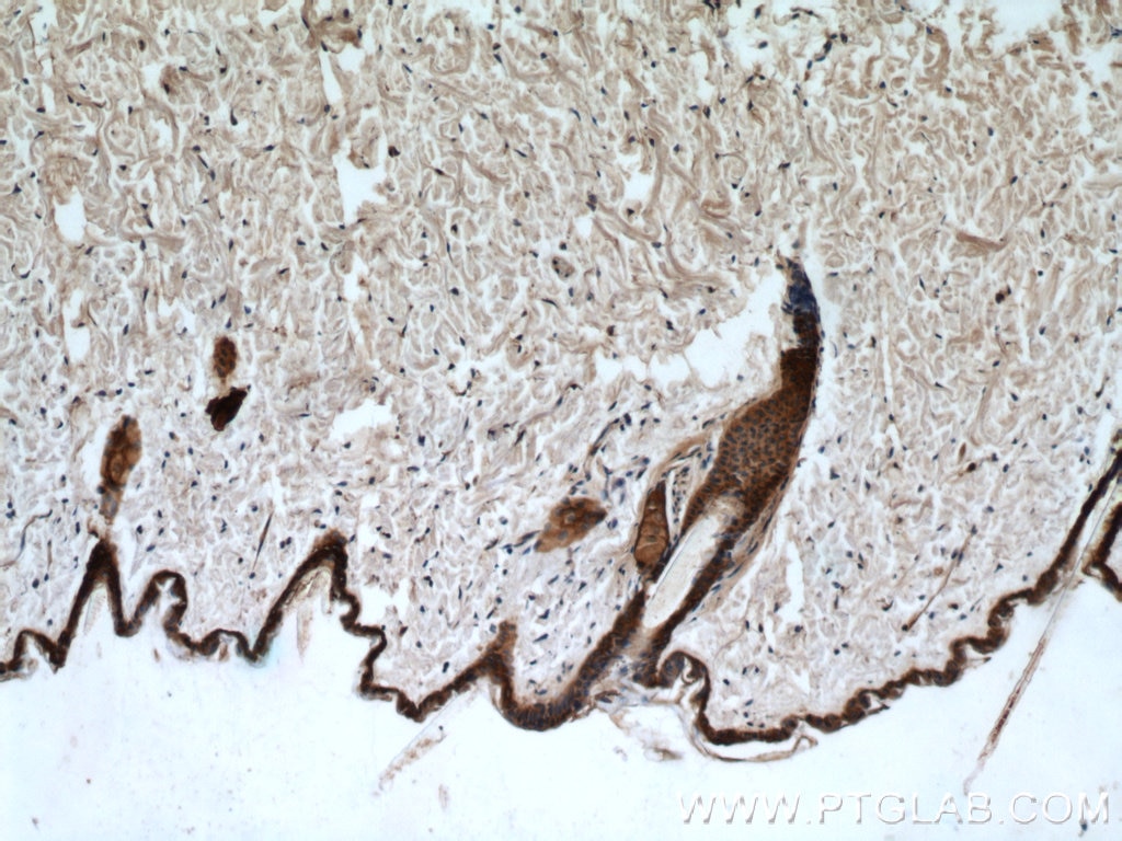 Immunohistochemistry of paraffin-embedded mouse skin using KRT14 Antibody 10143-1-AP (under 10x lens) KRT14 IHC Immunohistochemistry 10143-1-AP KRT14 Antibody CK14; EBS3; EBS4; K14; NFJ