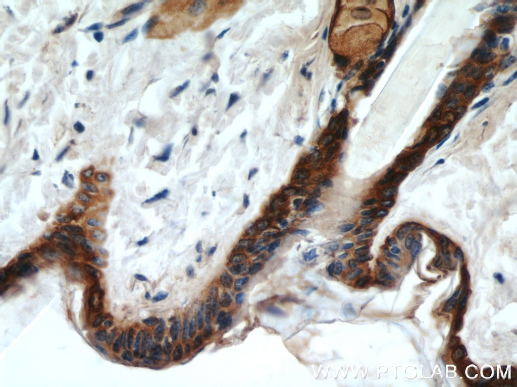 Immunohistochemistry of paraffin-embedded mouse skin using KRT14 Antibody 10143-1-AP (under 40x lens) KRT14 IHC Immunohistochemistry 10143-1-AP KRT14 Antibody CK14; EBS3; EBS4; K14; NFJ