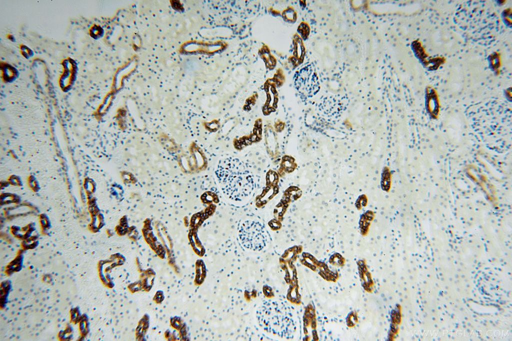 Immunohistochemistry of paraffin-embedded human kidney using KRT14 Antibody 10143-1-AP (under 10x lens) KRT14 IHC Immunohistochemistry 10143-1-AP KRT14 Antibody CK14; EBS3; EBS4; K14; NFJ