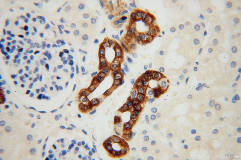 Immunohistochemistry of paraffin-embedded human kidney using KRT14 Antibody 10143-1-AP (under 40x lens) KRT14 IHC Immunohistochemistry 10143-1-AP KRT14 Antibody CK14; EBS3; EBS4; K14; NFJ