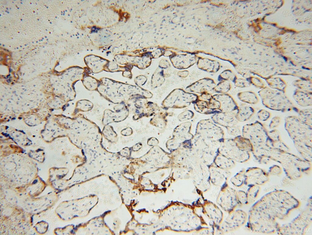 Immunohistochemistry of paraffin-embedded human placenta using KRT14 Antibody 10143-1-AP (under 10x lens) KRT14 IHC Immunohistochemistry 10143-1-AP KRT14 Antibody CK14; EBS3; EBS4; K14; NFJ