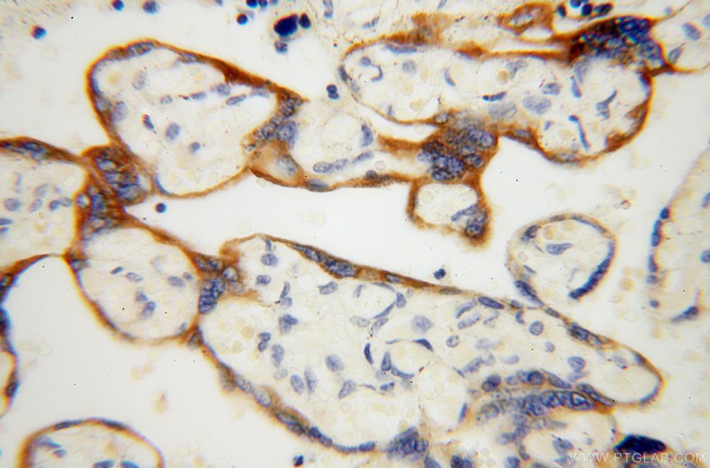 Immunohistochemistry of paraffin-embedded human placenta using KRT14 Antibody 10143-1-AP (under 40x lens) KRT14 IHC Immunohistochemistry 10143-1-AP KRT14 Antibody CK14; EBS3; EBS4; K14; NFJ