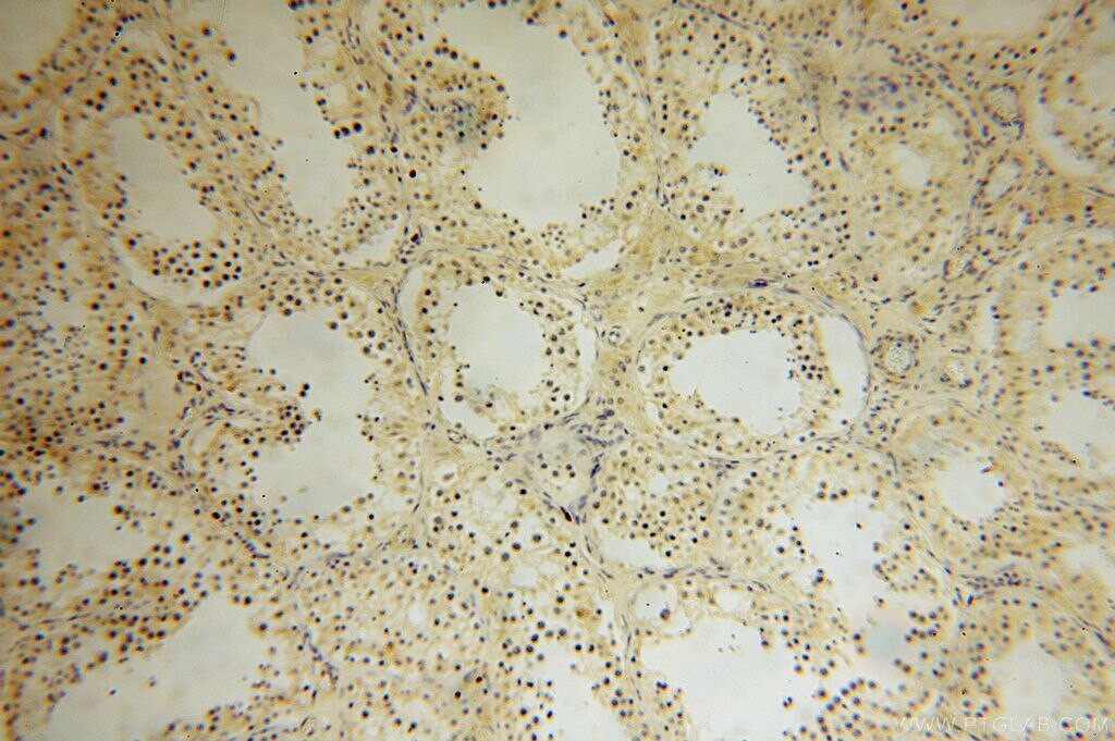 Immunohistochemistry of paraffin-embedded human testis using KRT14 Antibody 10143-1-AP (under 10x lens) KRT14 IHC Immunohistochemistry 10143-1-AP KRT14 Antibody CK14; EBS3; EBS4; K14; NFJ