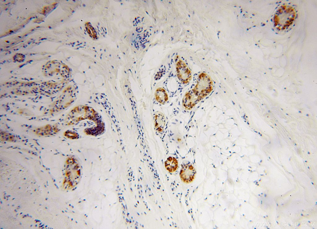 Immunohistochemistry of paraffin-embedded human skin using KRT14 Antibody 10143-1-AP (under 10x lens) KRT14 IHC Immunohistochemistry 10143-1-AP KRT14 Antibody CK14; EBS3; EBS4; K14; NFJ