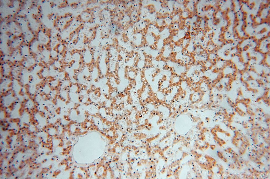 Immunohistochemistry of paraffin-embedded human liver using KRT14 Antibody 10143-1-AP (under 10x lens) KRT14 IHC Immunohistochemistry 10143-1-AP KRT14 Antibody CK14; EBS3; EBS4; K14; NFJ