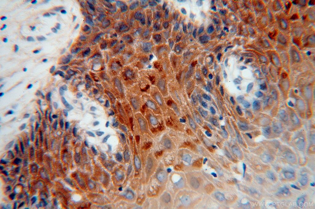 KRT14 IHC Immunohistochemical 10143-1-AP KRT14 Antibody CK14; EBS3; EBS4; K14; NFJ
