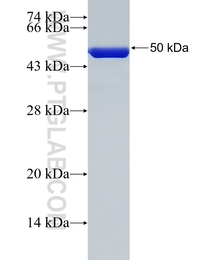 KRT14 fusion protein ag0188 SDS-PAGE