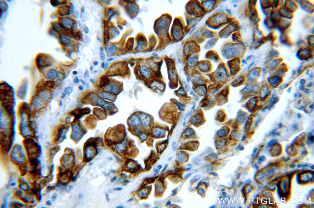 KRT19-specific IHC Immunohistochemical 16858-1-AP KRT19-specific Antibody CK19; K19; K1CS; MGC15366