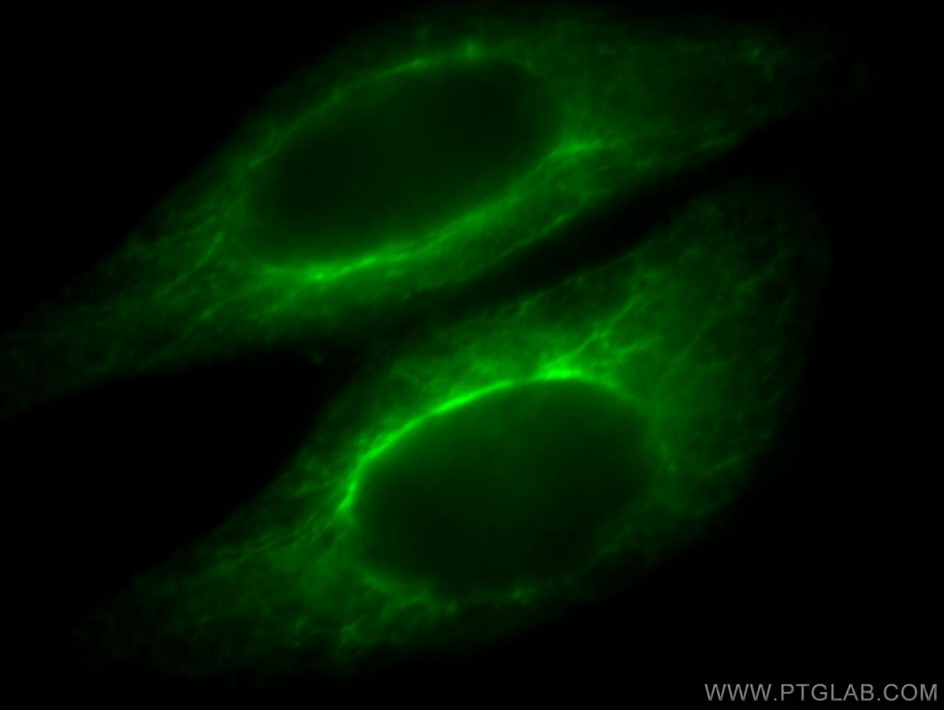 KRT34 Immunofluorescence IF 20449-1-AP KRT34 Antibody HA4; Ha-4; KRTHA4; hHa4