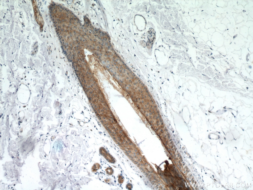 KRT34 IHC Immunohistochemical 20449-1-AP KRT34 Antibody HA4; Ha-4; KRTHA4; hHa4