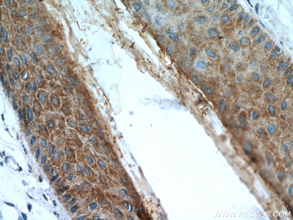 KRT34 IHC Immunohistochemical 20449-1-AP KRT34 Antibody HA4; Ha-4; KRTHA4; hHa4