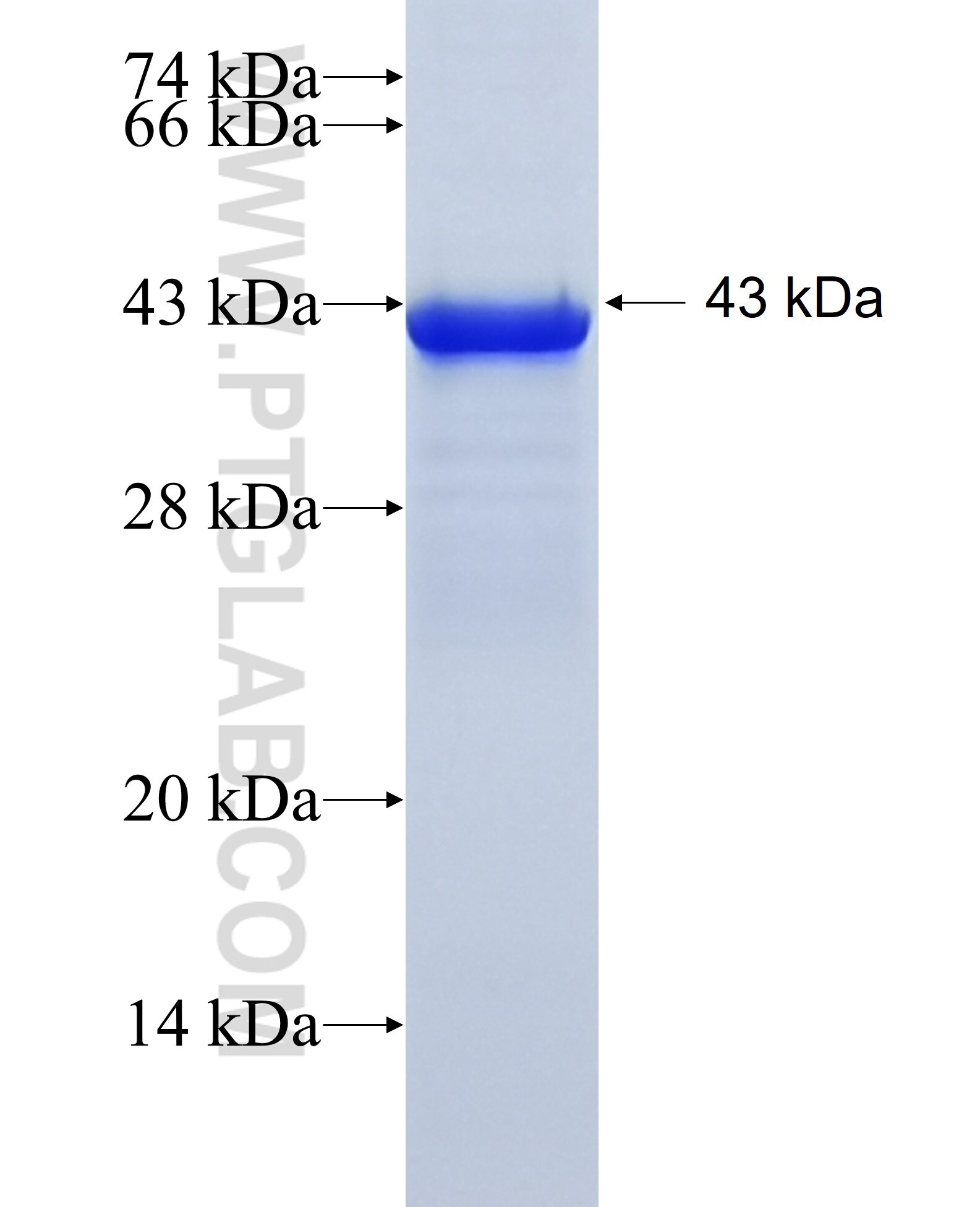 KRT6B fusion protein ag11241 SDS-PAGE