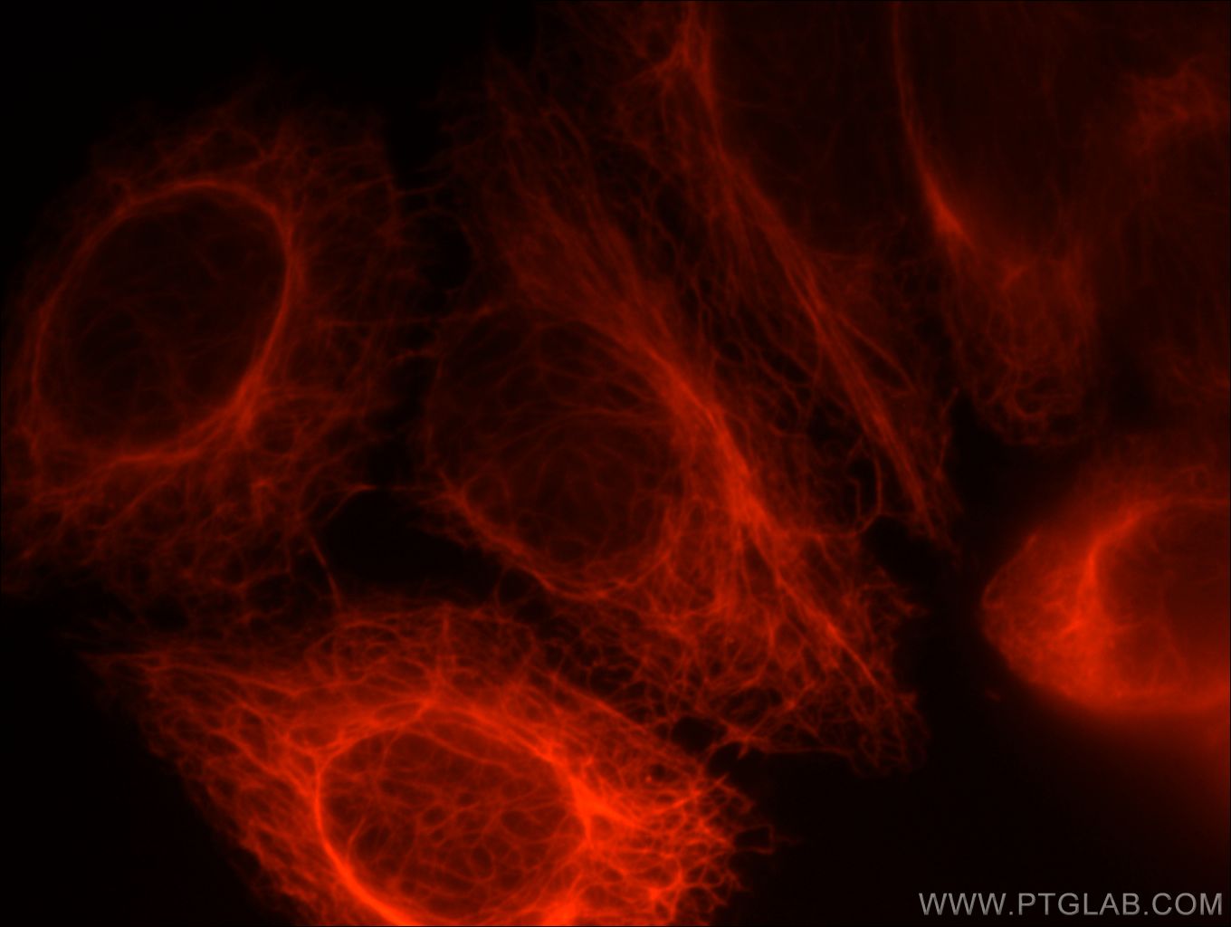 KRT7-Specific Immunofluorescence IF 17513-1-AP KRT7-Specific Antibody CK7; K2C7; K7; MGC129731; MGC3625; SCL