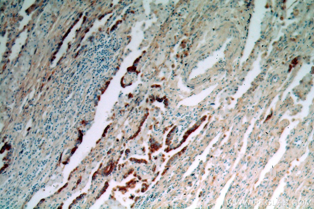 KRT7-Specific IHC Immunohistochemical 17513-1-AP KRT7-Specific Antibody CK7; K2C7; K7; MGC129731; MGC3625; SCL