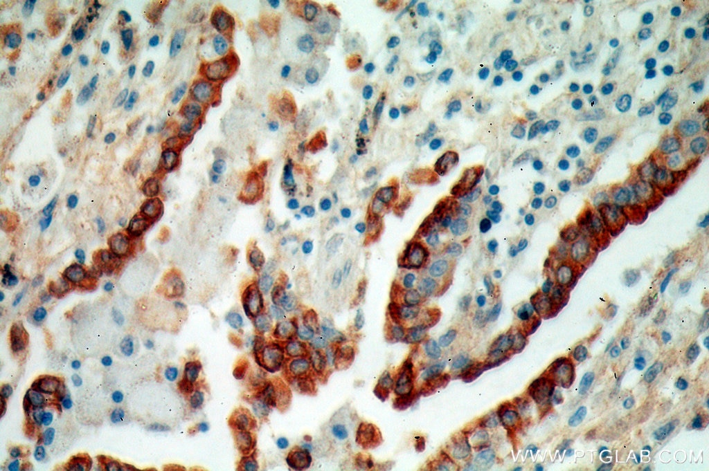 KRT7-Specific IHC Immunohistochemical 17513-1-AP KRT7-Specific Antibody CK7; K2C7; K7; MGC129731; MGC3625; SCL