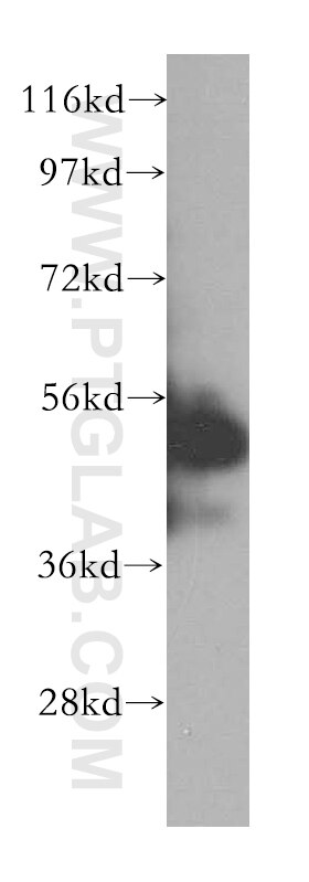 KRT7-Specific western blot WB 17513-1-AP KRT7-Specific Antibody CK7; K2C7; K7; MGC129731; MGC3625; SCL