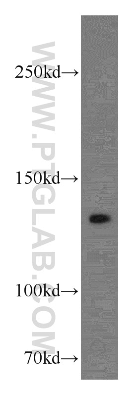 A431 cells were subjected to SDS PAGE followed by western blot with 19698-1-AP(LAMC2 Antibody) at dilution of 1:1000 LAMC2 western blot WB 19698-1-AP LAMC2 Antibody B2T; BM600; CSF; EBR2; EBR2A; LAMB2T; LAMNB2; MGC138491; MGC141938