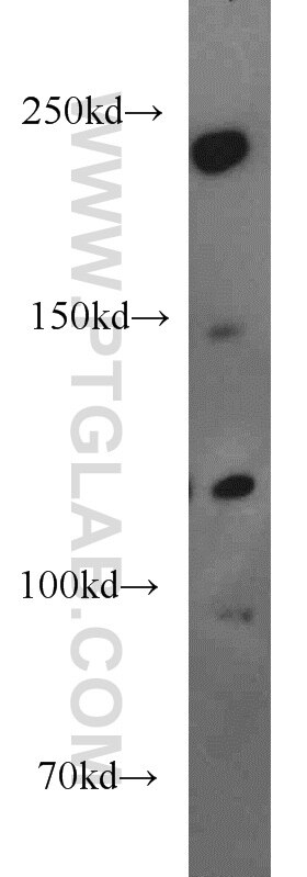 LAMC3-Specific western blot WB 20030-1-AP LAMC3-Specific Antibody DKFZp434E202