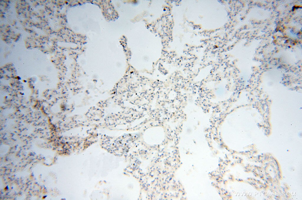 LAMP3 IHC Immunohistochemical 12632-1-AP LAMP3 Antibody CD208; DC-LAMP; DCLAMP; LAMP; TSC403