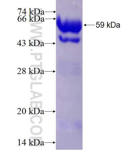 LARP1 fusion protein ag4645 SDS-PAGE