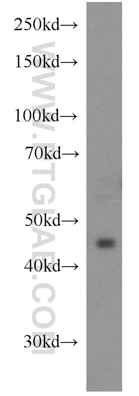 HeLa cells were subjected to SDS PAGE followed by western blot with 21557-1-AP(LAX1 Antibody) at dilution of 1:1500 LAX1 western blot WB 21557-1-AP LAX1 Antibody FLJ20340; LAX