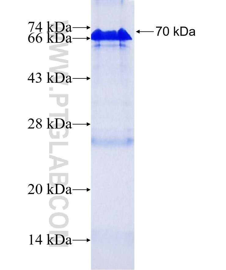 LDLR fusion protein ag1236 SDS-PAGE