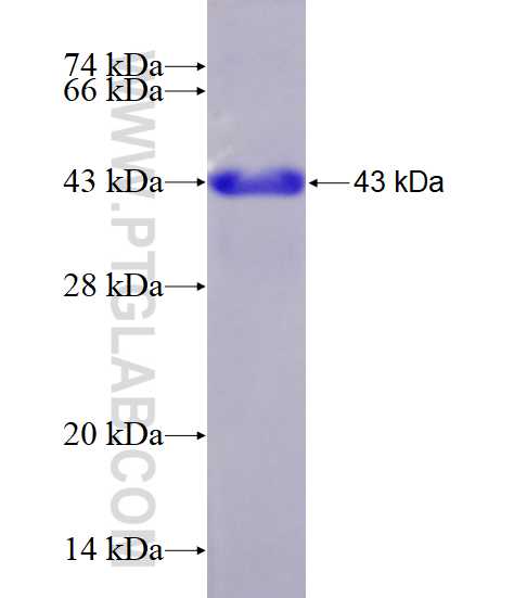 LDOC1 fusion protein ag0158 SDS-PAGE