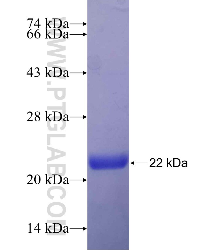 LEP fusion protein ag11475 SDS-PAGE