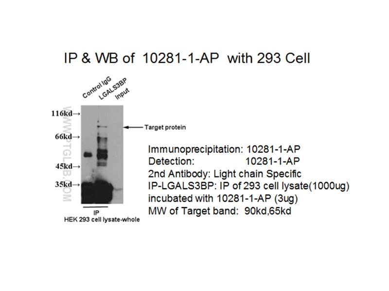 LGALS3BP IP 10281-1-AP LGALS3BP Antibody 90K; BTBD17B; MAC-2-BP