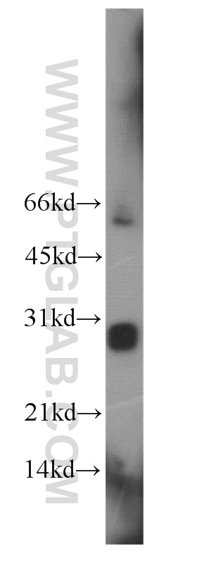 LIN28 western blot WB 11724-1-AP LIN28 Antibody LIN28;CSDD1;FLJ12457;LIN-28;LIN28A;ZCCHC1 ;