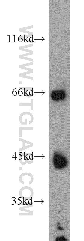 mouse liver tissue were subjected to SDS PAGE followed by western blot with 21133-1-AP(LIPC Antibody) at dilution of 1:600 LIPC western blot WB 21133-1-AP LIPC Antibody HDLCQ12; HL; HTGL; LIPH